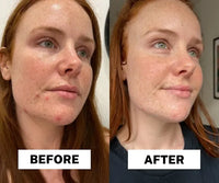 Dr.Melaxin Official Peel Shot Keratin Care Kojic Acid Turmeric Spray
